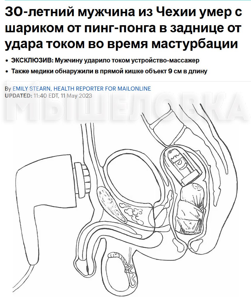 Мужик Умер От Дрочки