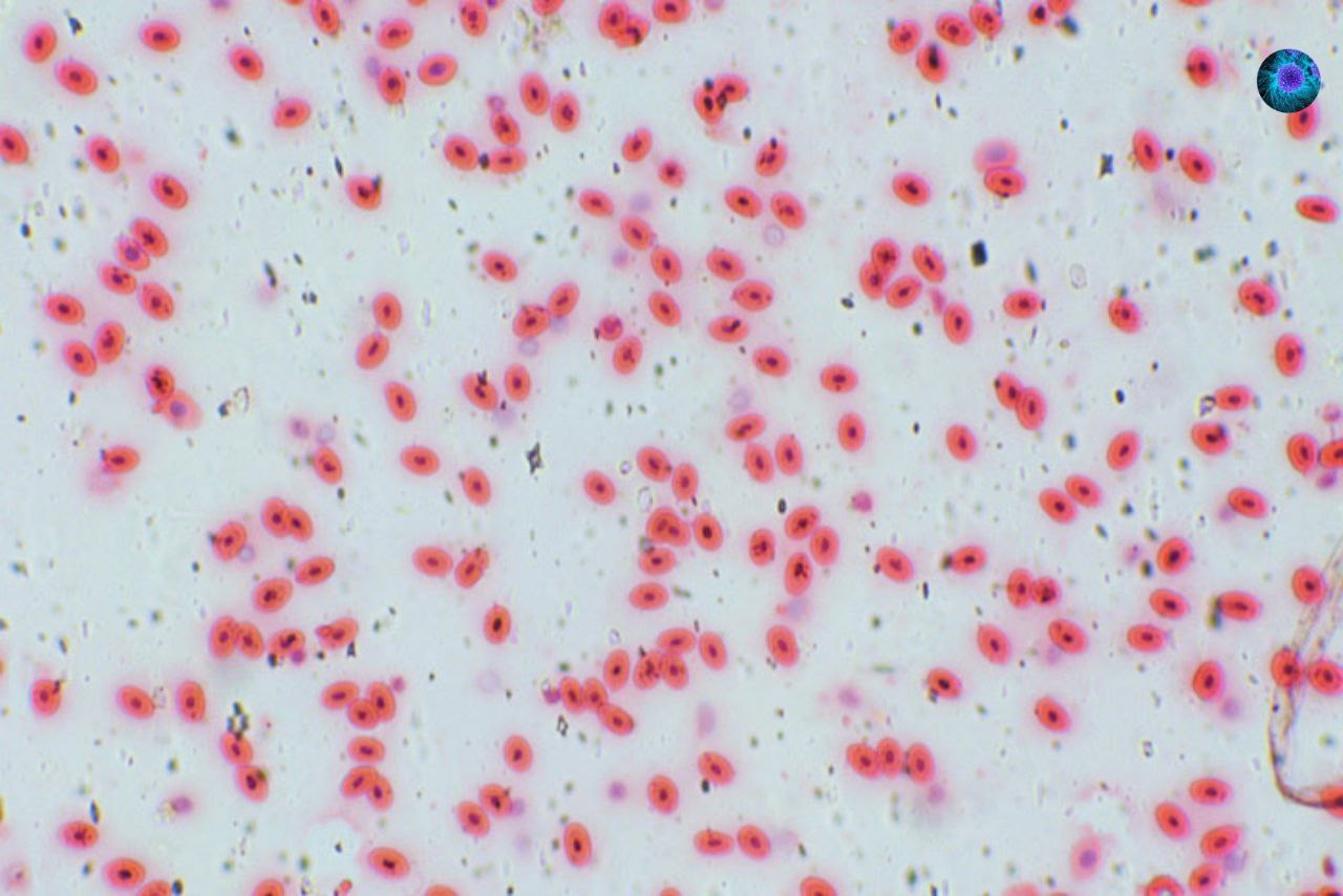 Кровь микро. Микропрепарат крови лягушки. Микропрепарат крови лягушки под микроскопом. Микропрепарат крови человека под микроскопом. Мазок крови лягушки препарат.
