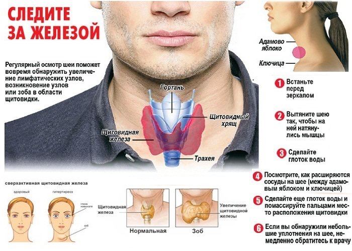 Как должна выглядеть щитовидка