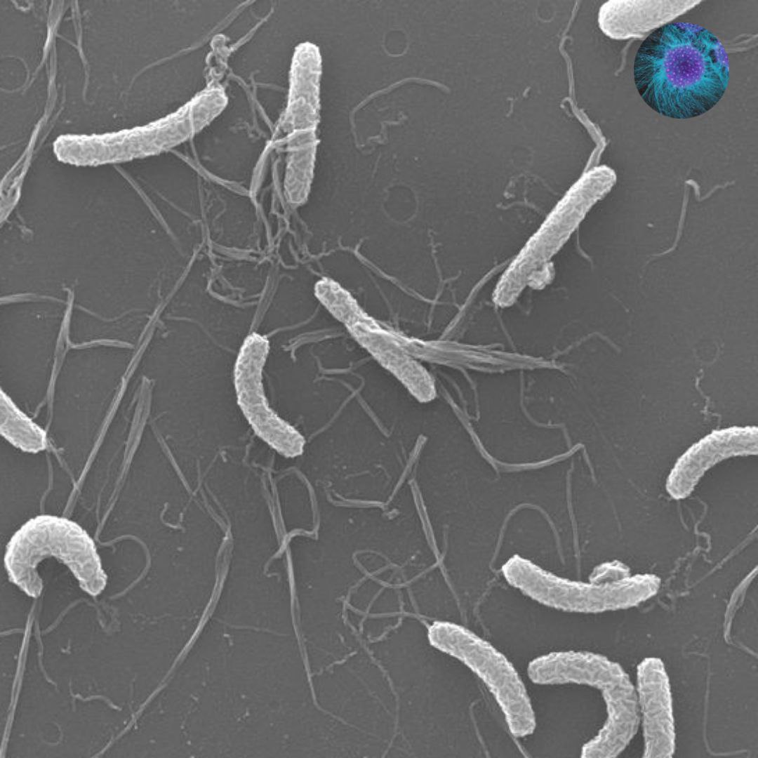 Холерный вибрион фото под микроскопом
