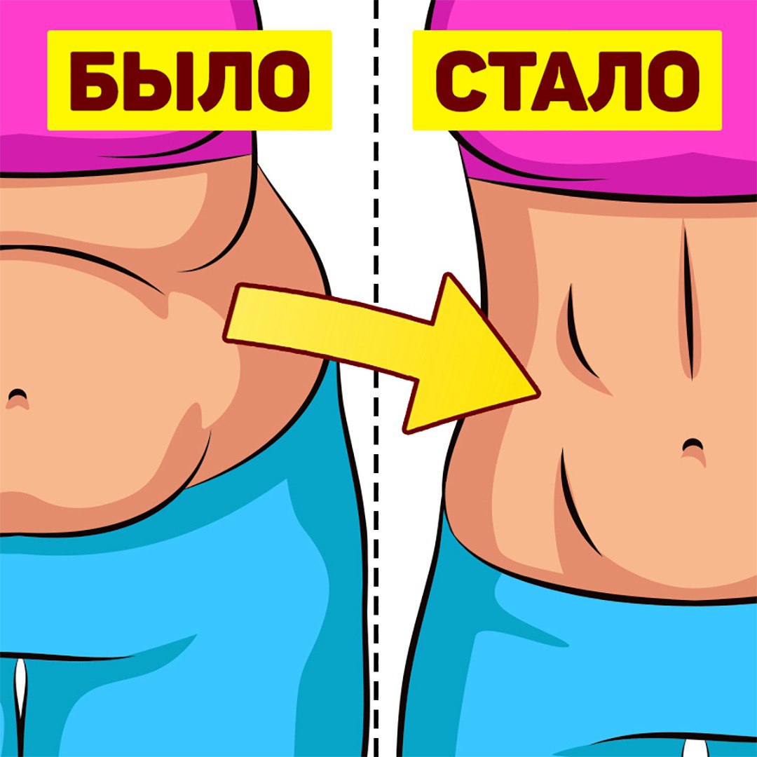 Жир на талии. Лазерная липосакция smartlipo. Похудение после 50 лет для женщин. Убрать возрастной живот у женщины. Убрать возрастной живот у женщины.